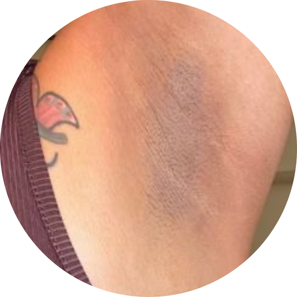 Avant - Après 4 semaines