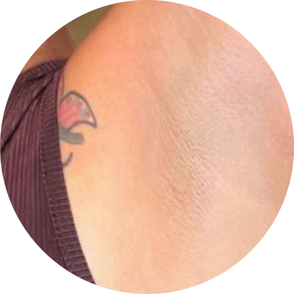 Après - Après 4 semaines